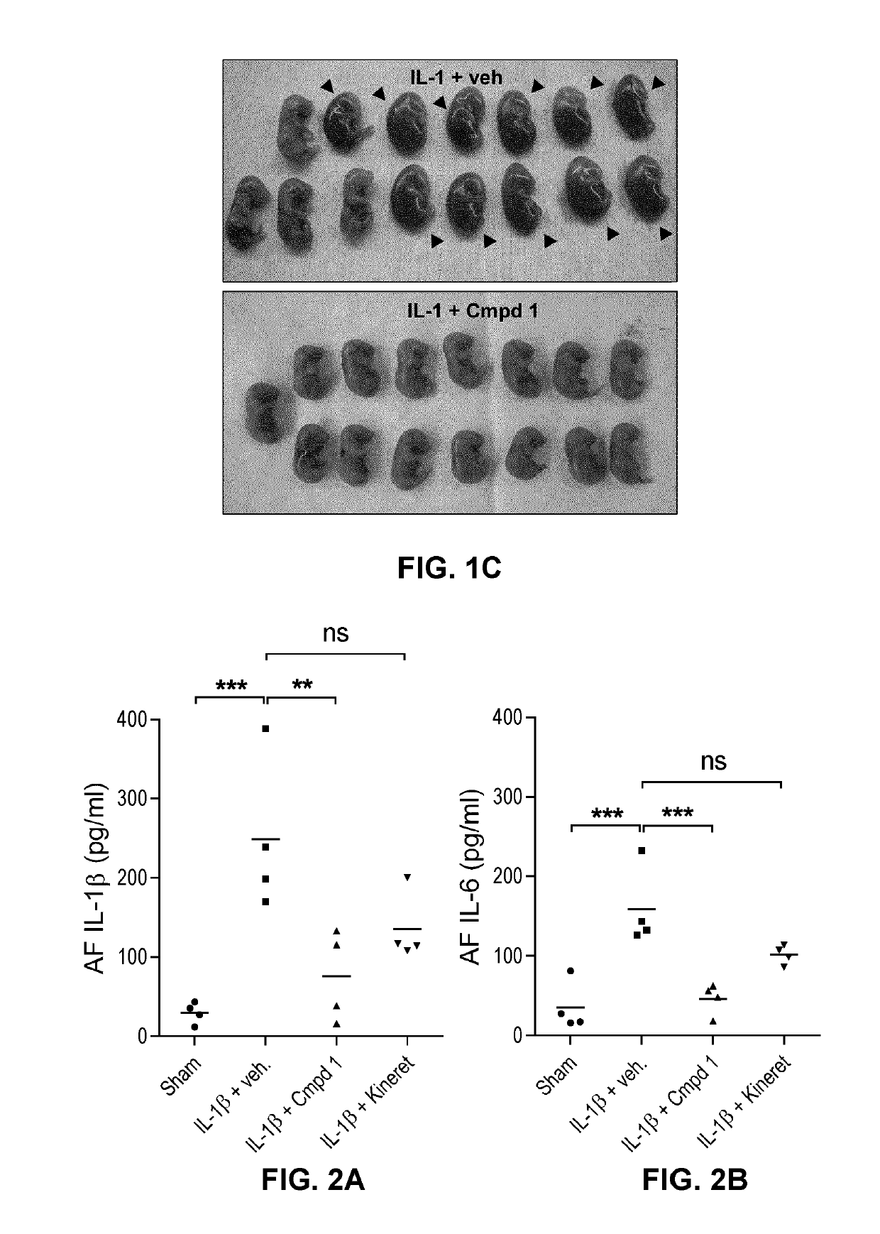 Methods for reducing perinatal morbidity and/or mortality