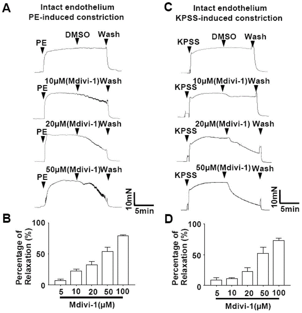 Application of chondriokinesis inhibitor in preparation of medicines for preventing and treating hypertension