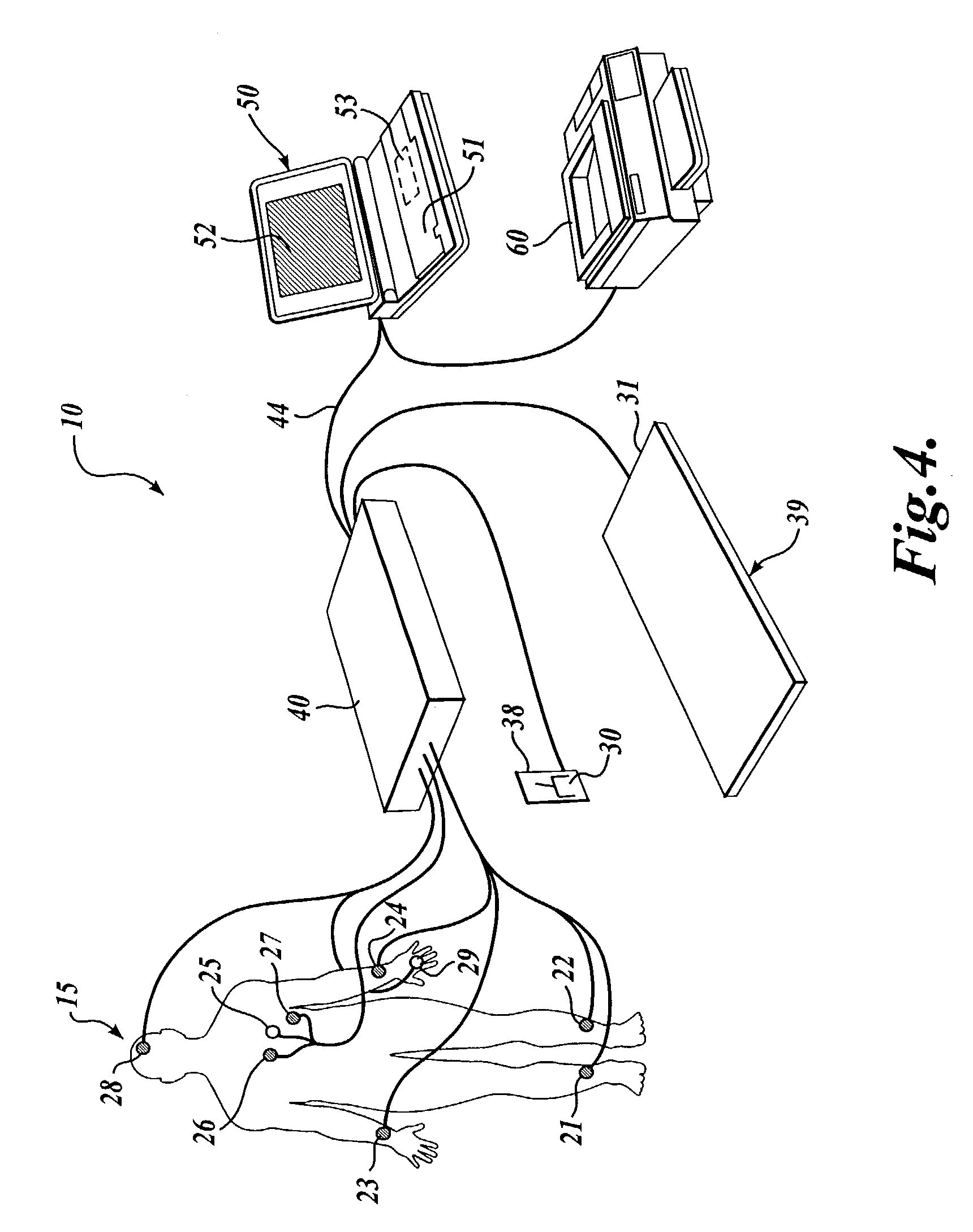 Methods for determining whether to provide an inhibitor of sympathetic nervous system activity to a human being suffering from an autoimmune disease or fibryomyalgia