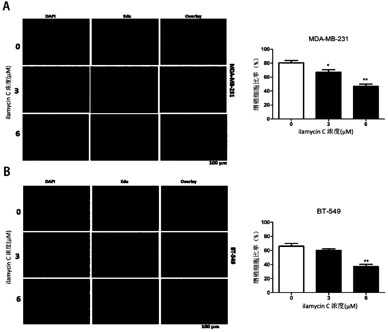 Application of compound ilamycin C and homologues thereof in preparation of drugs for treating triple negative breast cancer