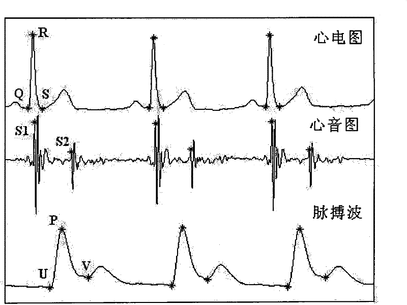 Physiological signal interval series-based cardiac function noninvasive detection device