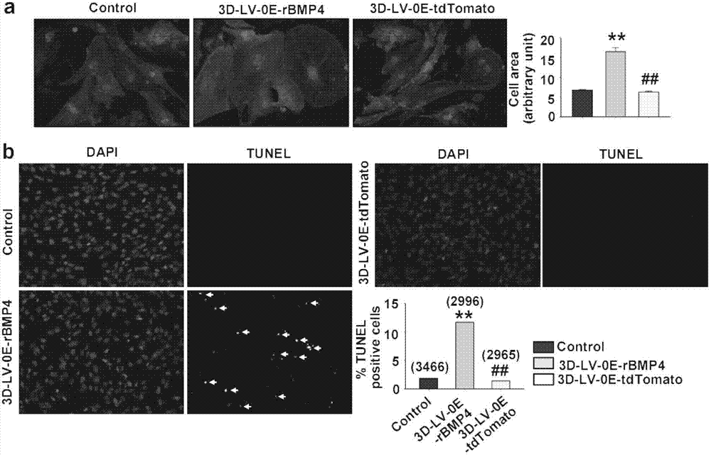 Application of bone morphogenetic protein-4 in screening drugs for resisting cardiac hypertrophy, heart failure or cardiac fibrosis