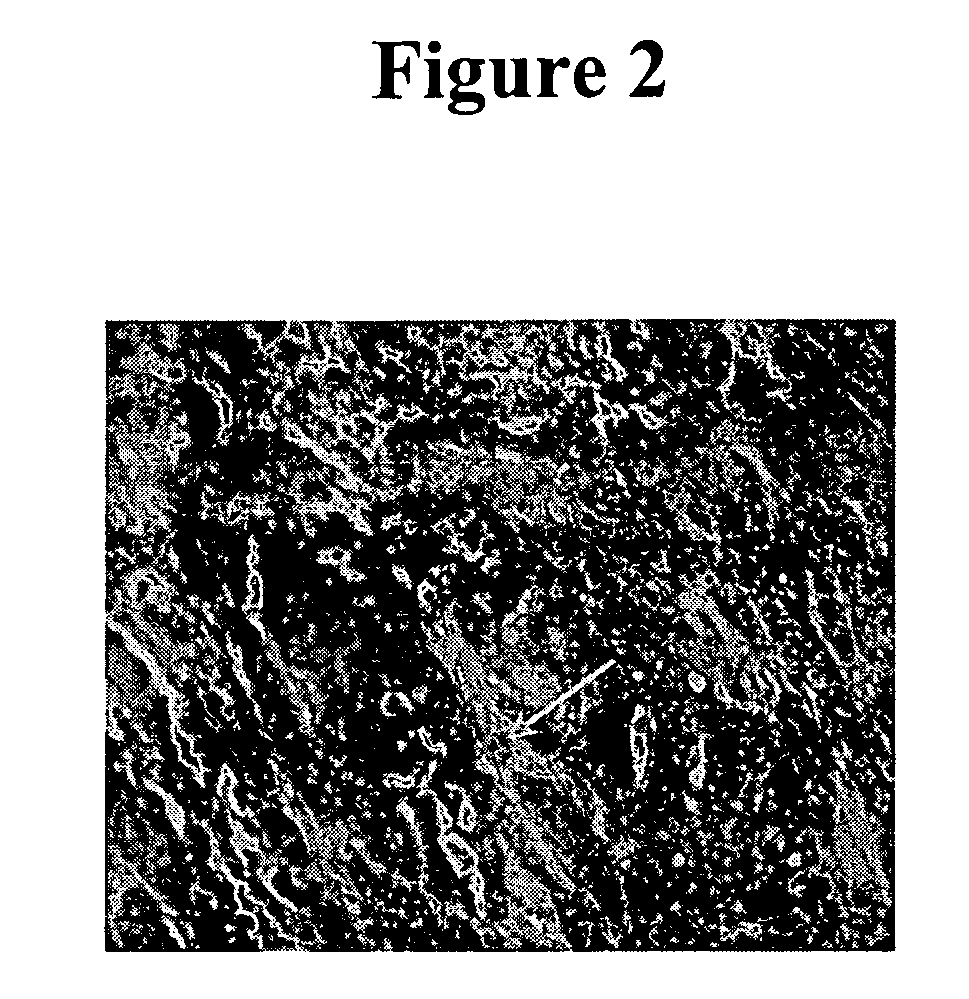 Cytotoxicity mediation of cells evidencing surface expression of CD44