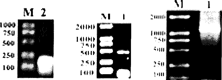 Recombined T4 bacteriophage of expressing cholecystokinin gene