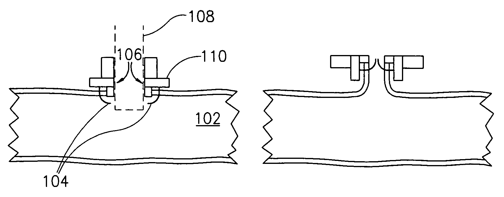 Vascular closure device