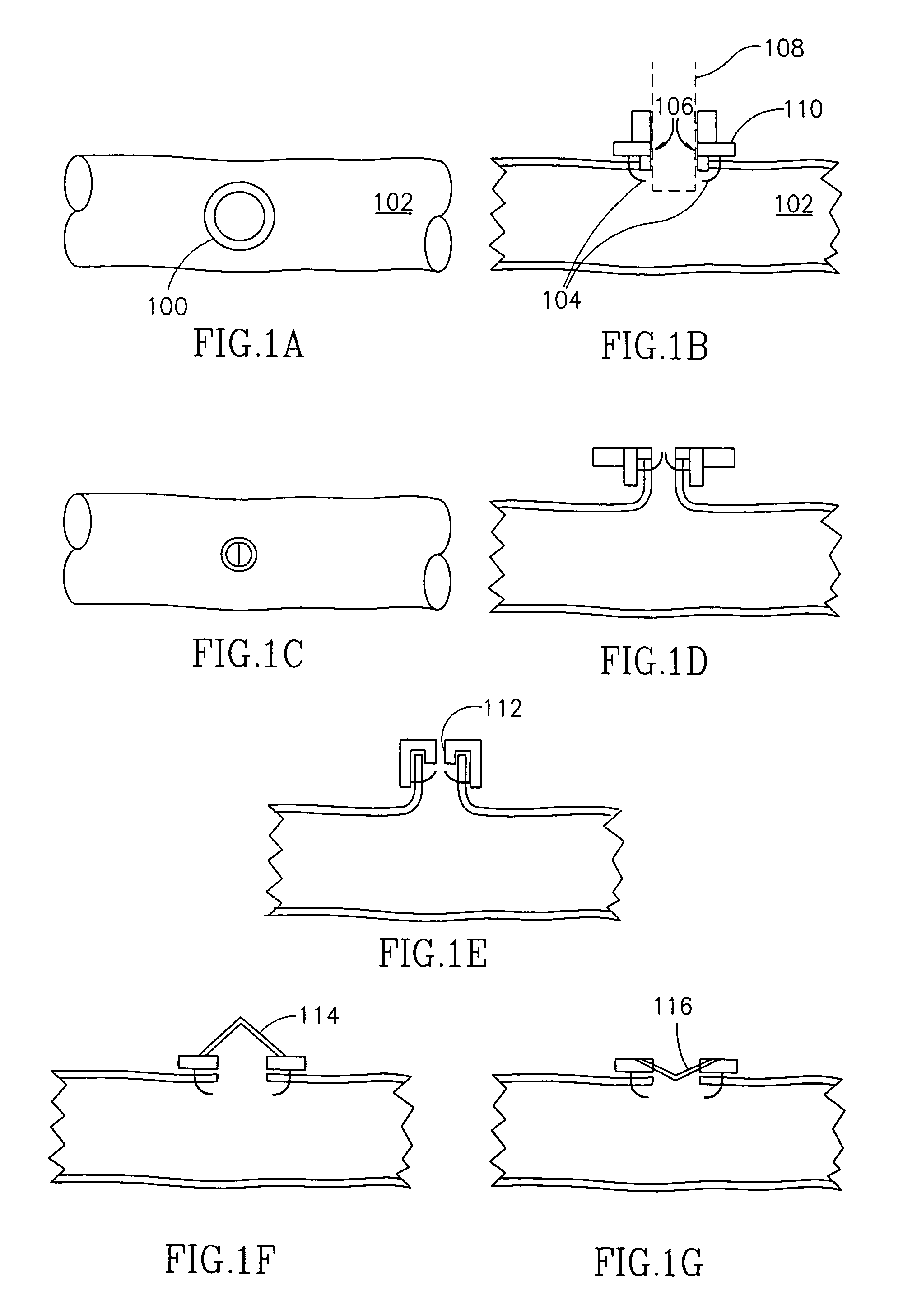 Vascular closure device