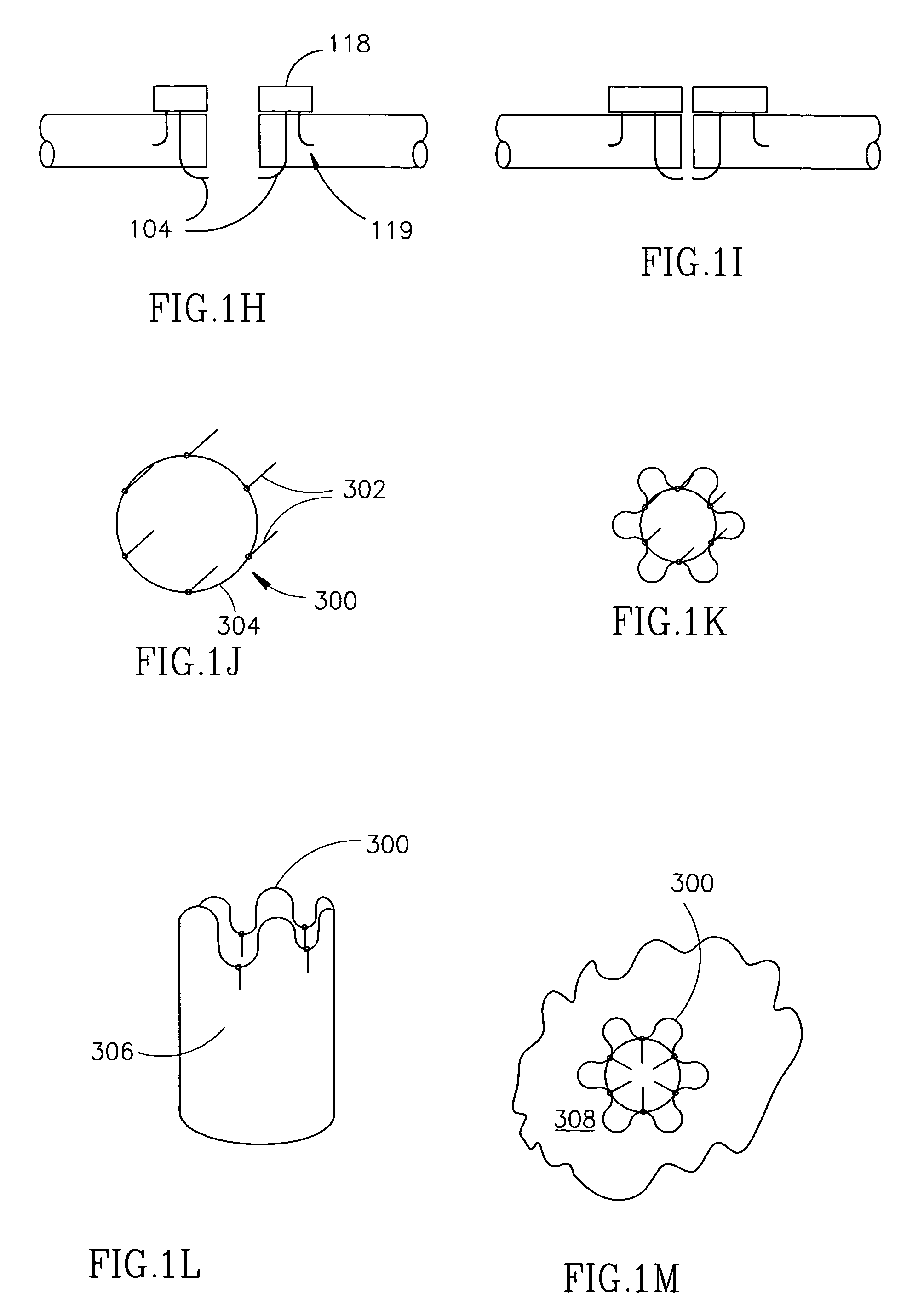 Vascular closure device