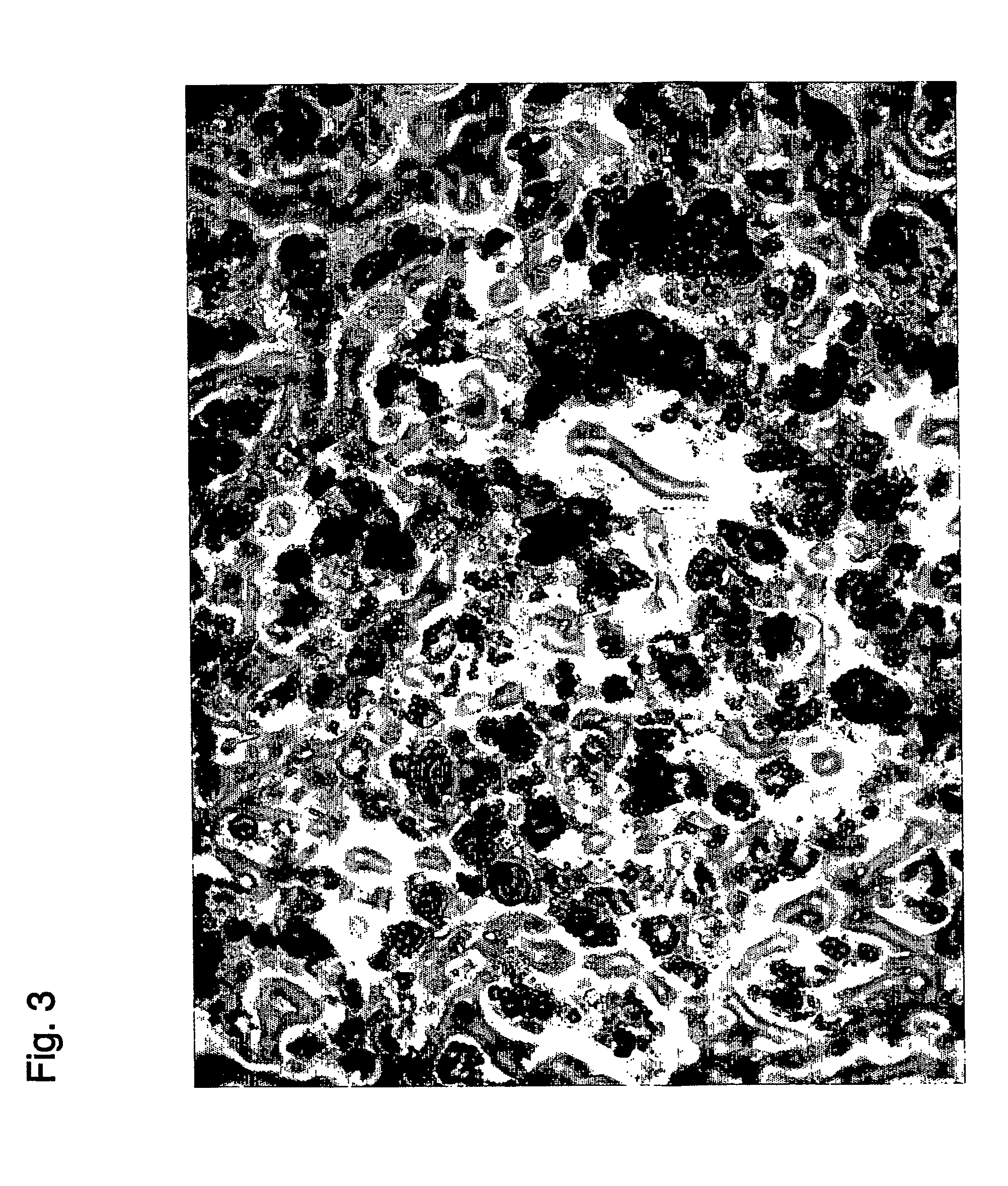 Method and system for preparing stem cells from fat tissue