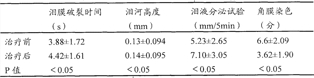 External traditional Chinese medicine composition for treating xerophthalmia and preparation method thereof