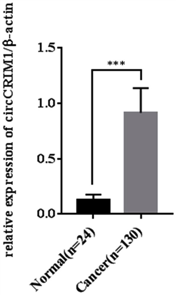 Circ-CRIM1 serving as ovarian cancer diagnosis marker and application thereof