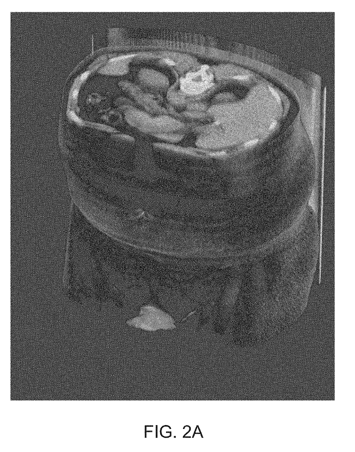 Systems and methods for rapid neural network-based image segmentation and radiopharmaceutical uptake determination