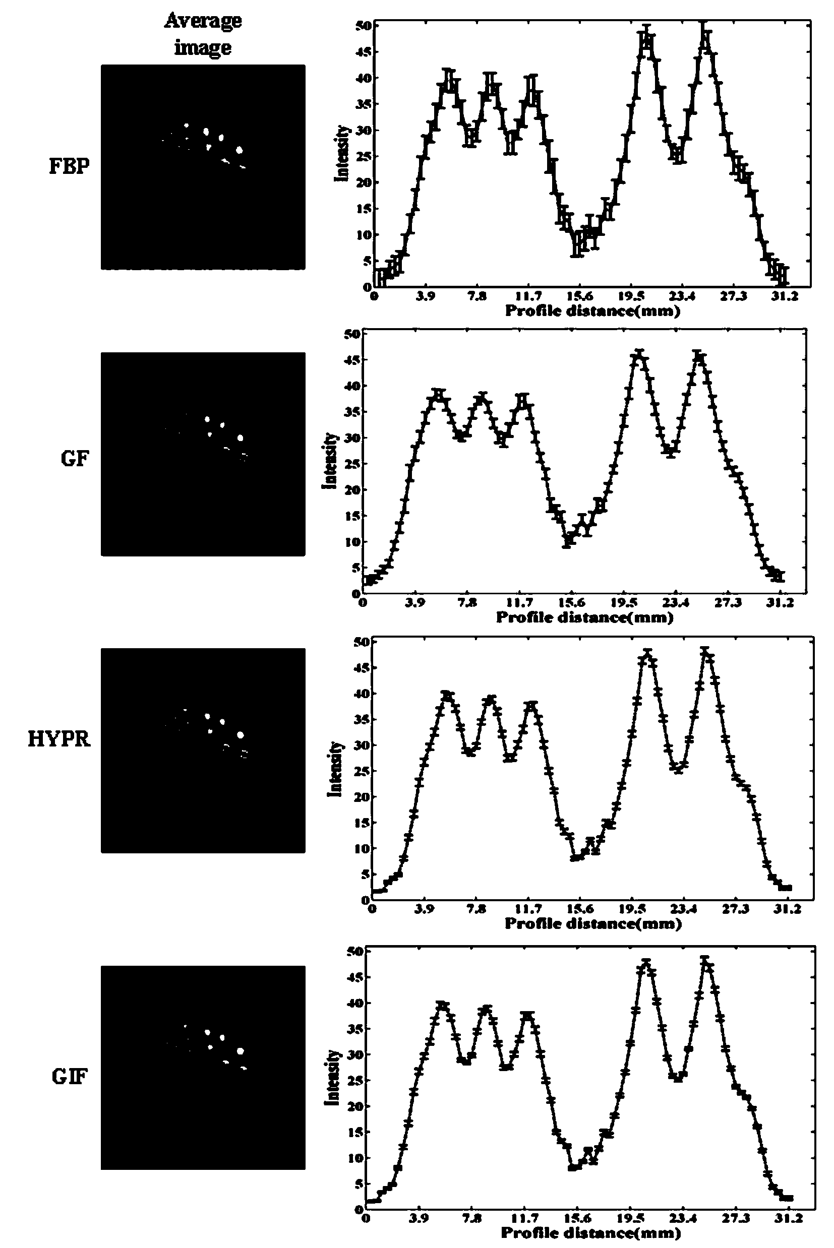 Dynamic PET image denoising method based on combined image guiding