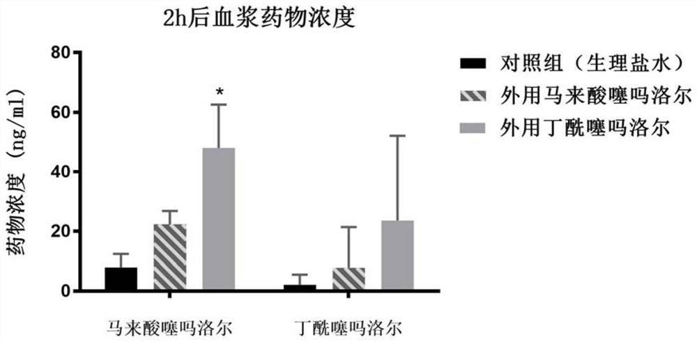 Application of timolol butyryl in preparation of medicine for treating superficial, mixed or deep hemangioma