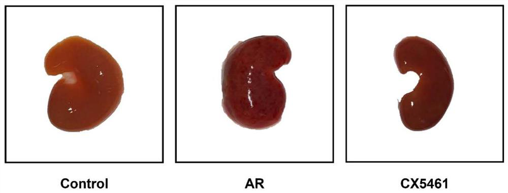 Application of CX-5461 in treatment of renal transplantation immunological rejection