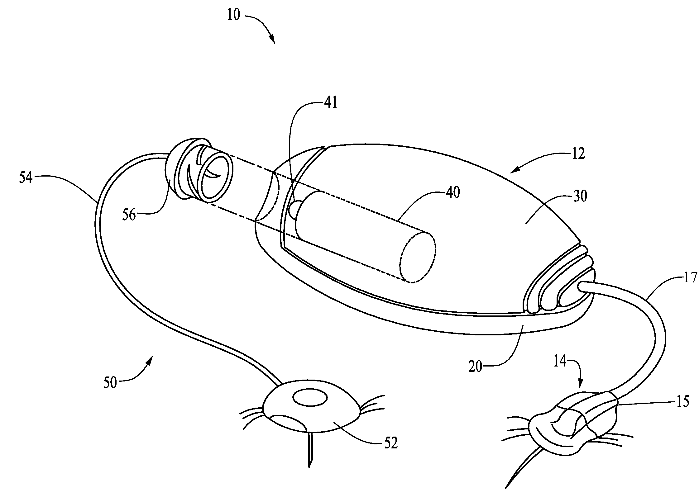 Reservoir barrier layer systems and methods