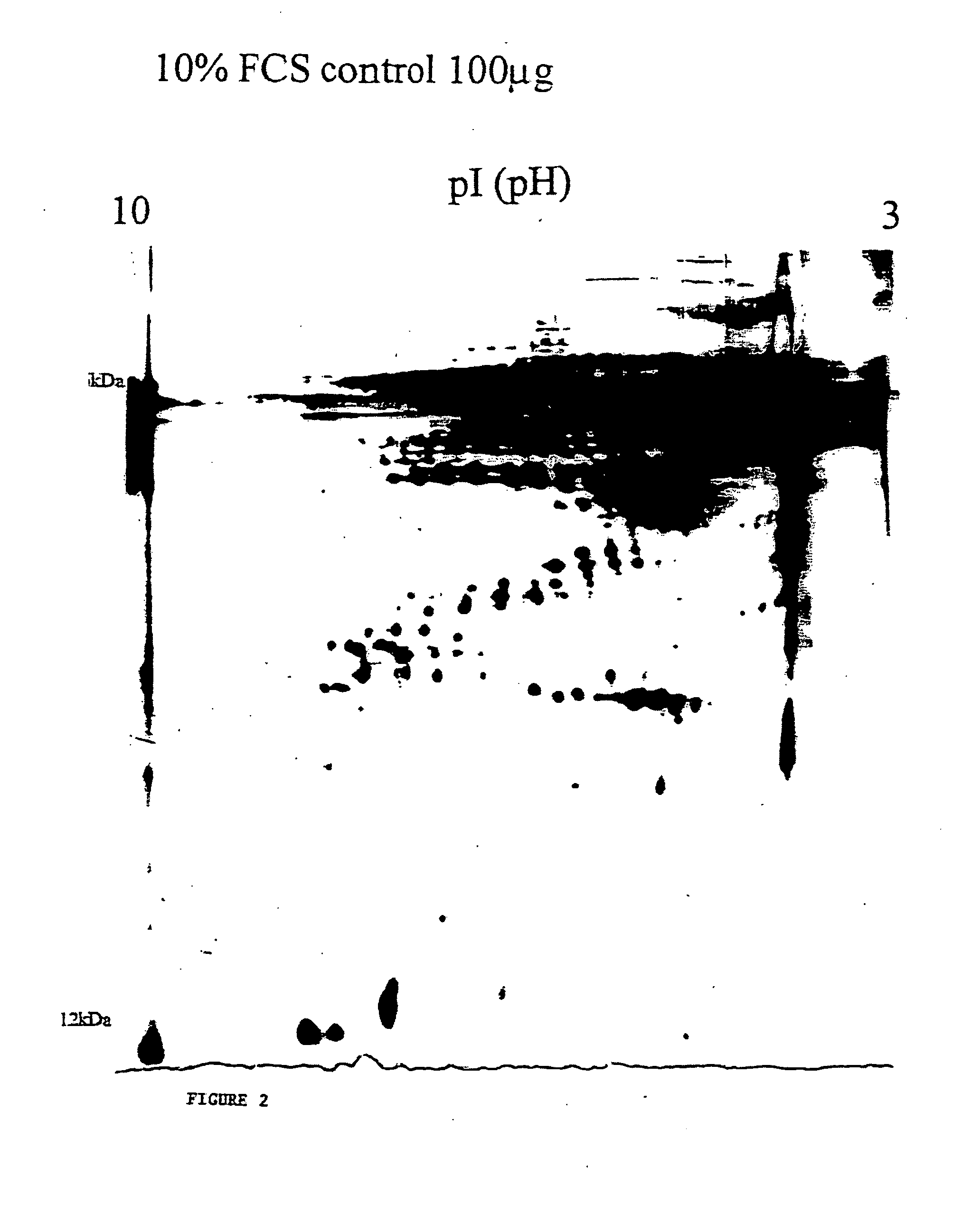 Therapeutic biological product and method for formation of new vascularised bone