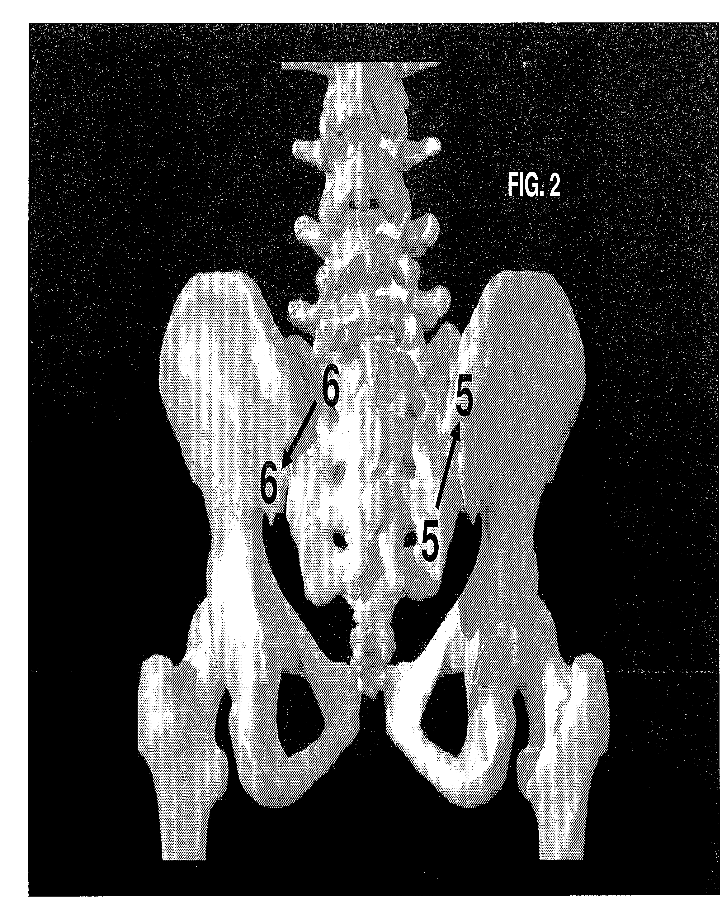 Method and System for Treating Patients