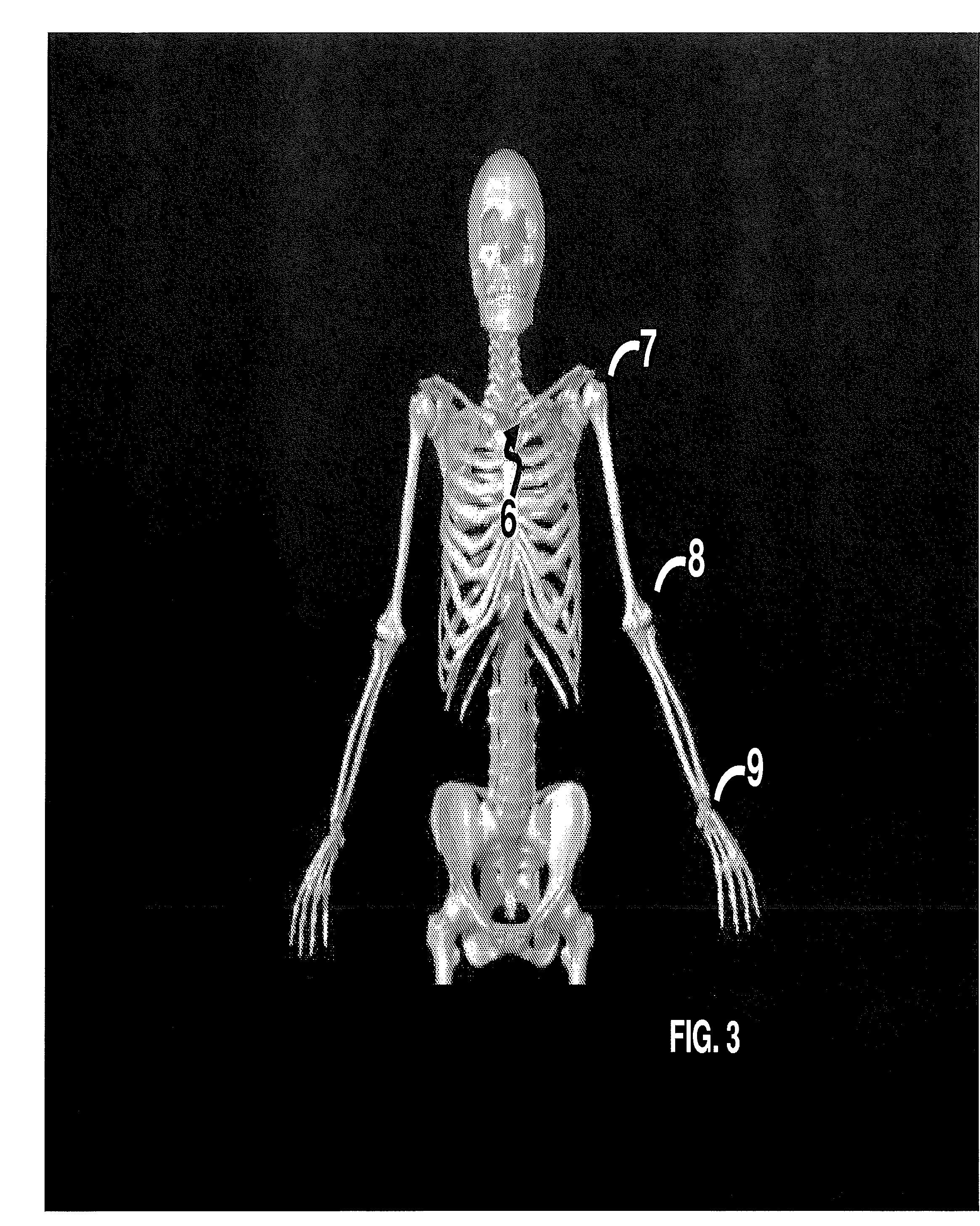 Method and System for Treating Patients