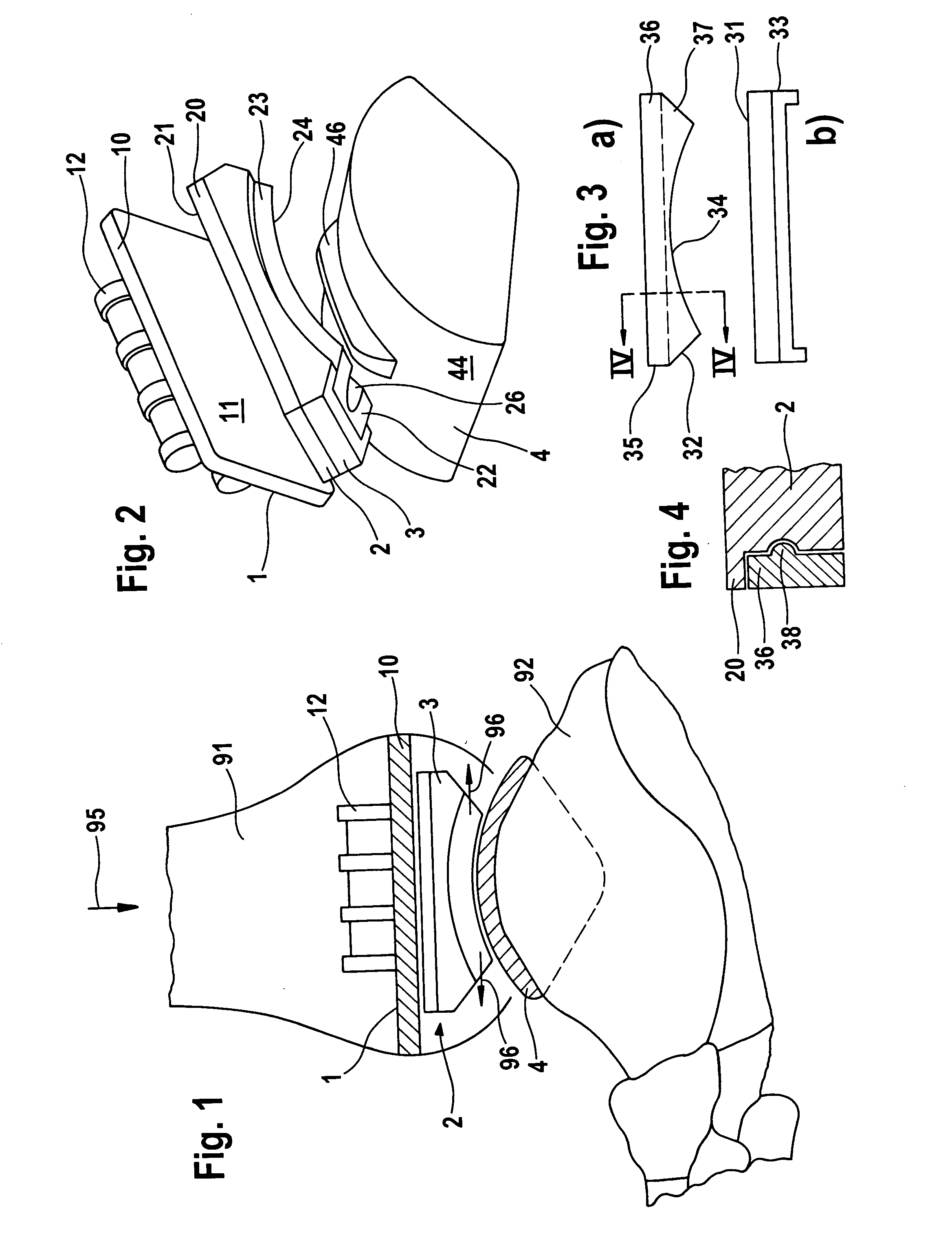 Endoprosthesis with intermediate part