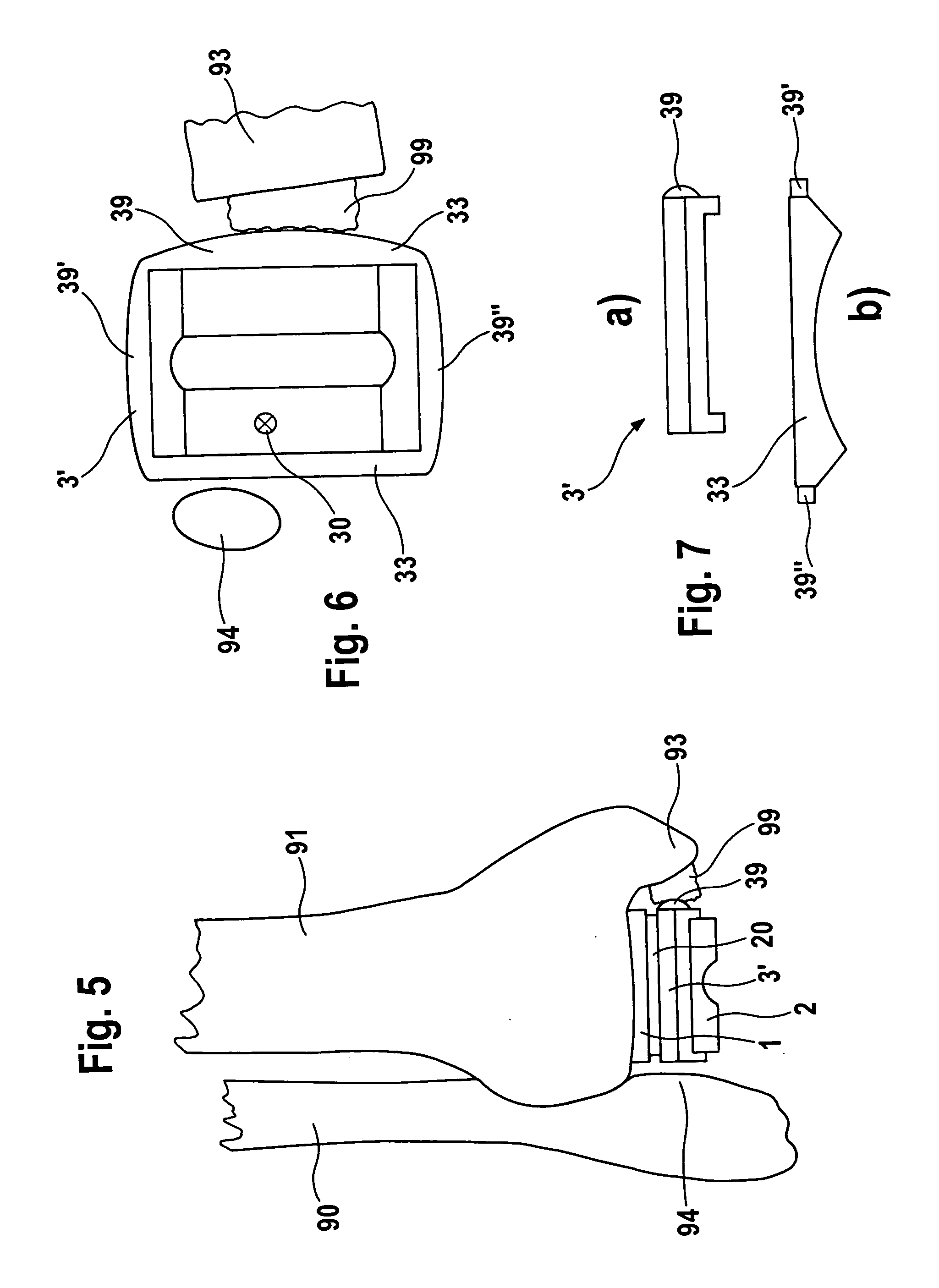 Endoprosthesis with intermediate part