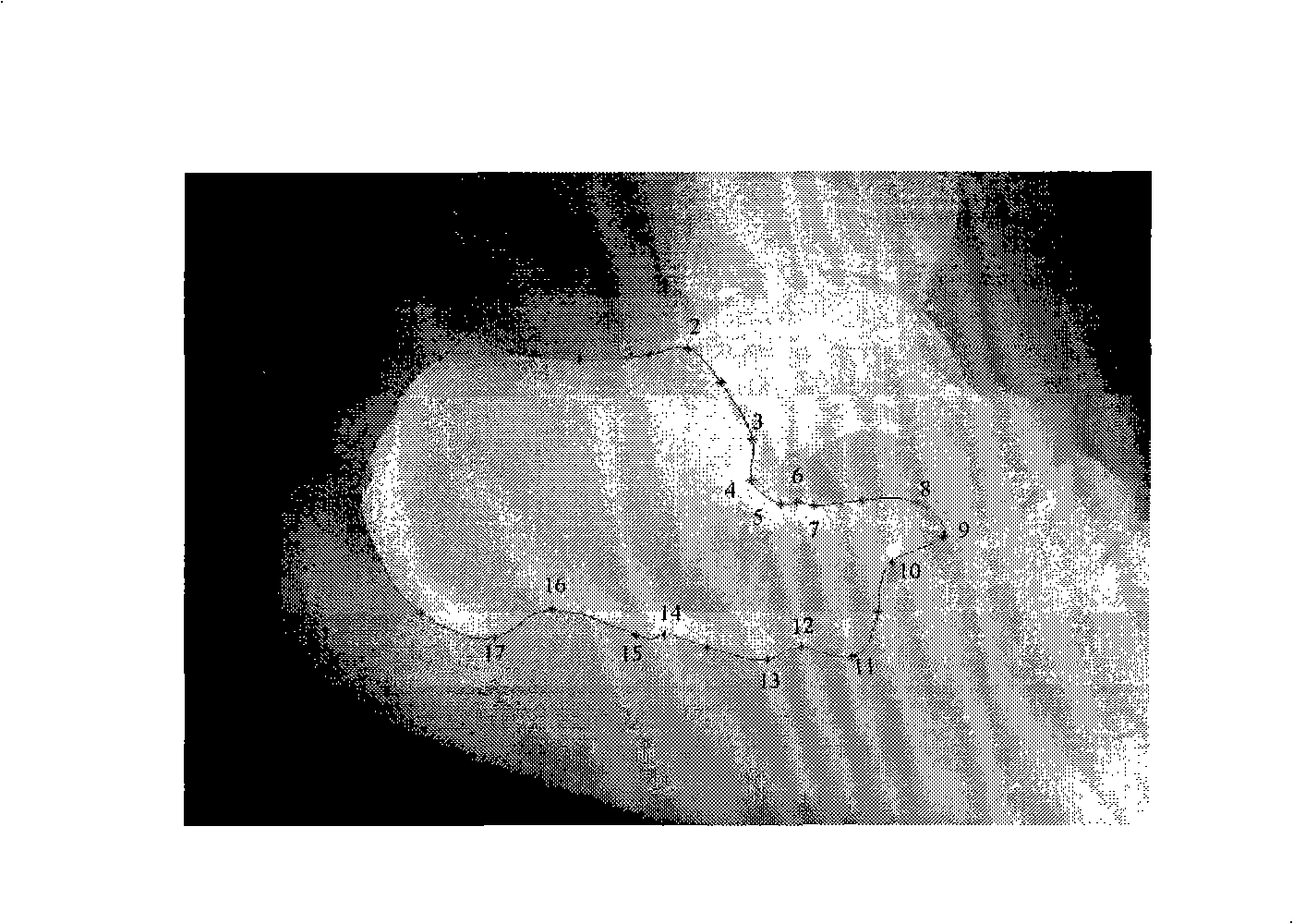 Method for analysis of picture distortion based on constant moment