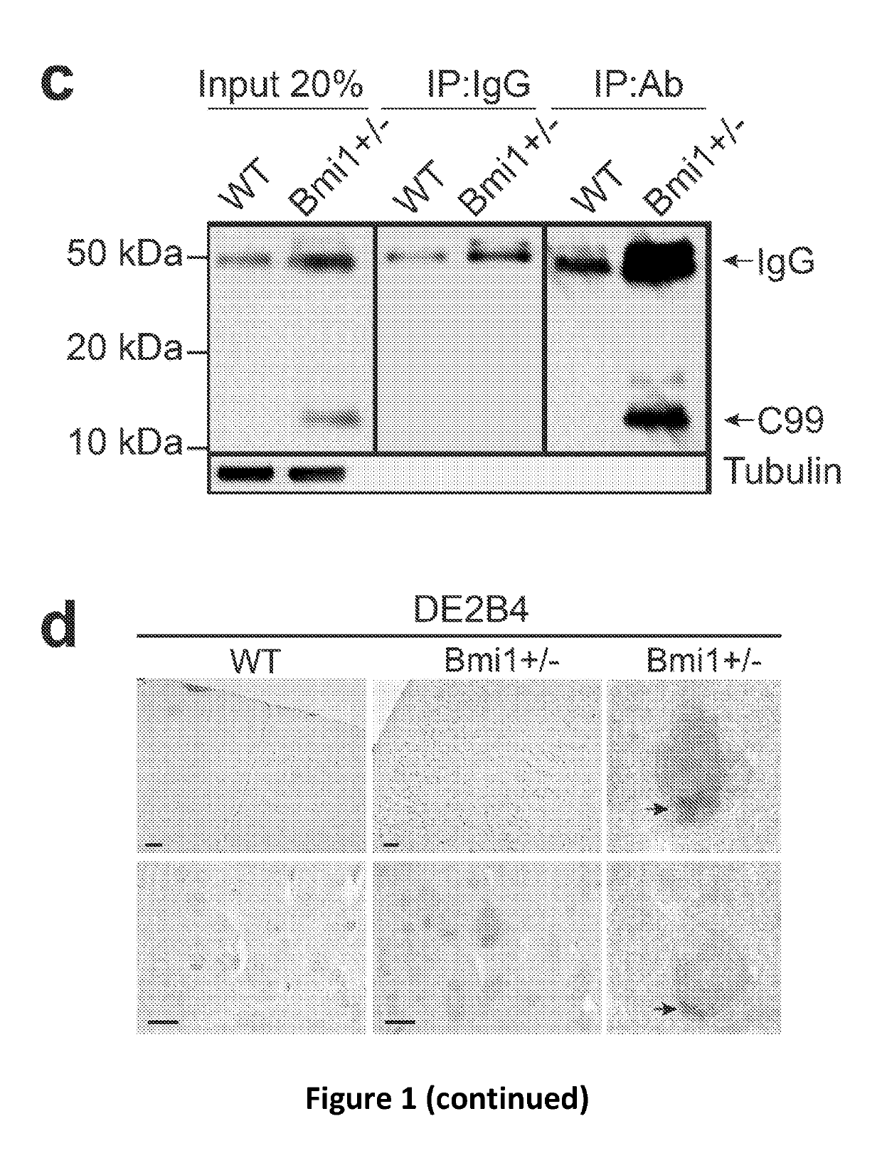 Cortical neuron cell model of alzheimer's disease based on bmi1 deficiency, and uses thereof