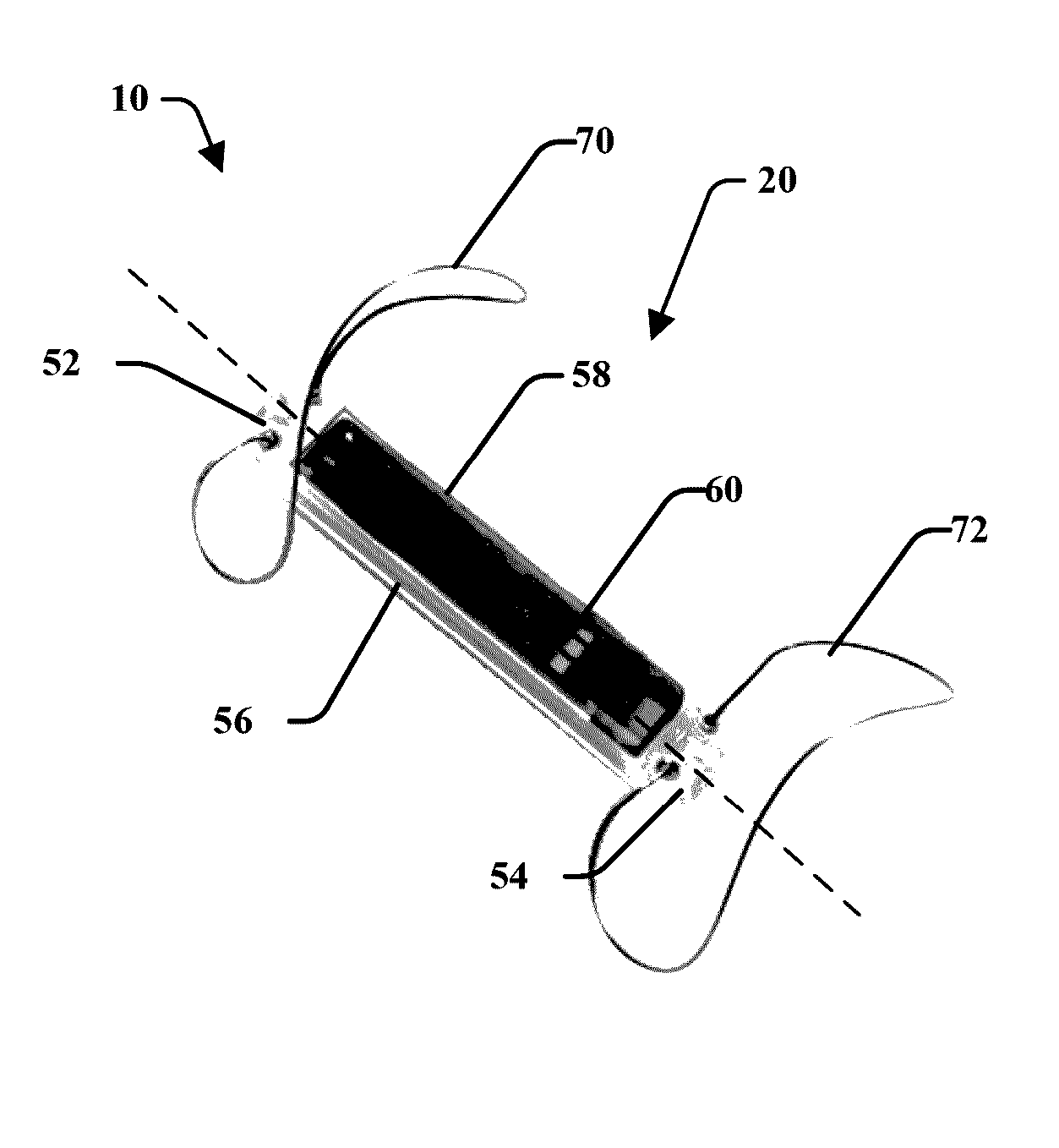 Pressure sensing implant