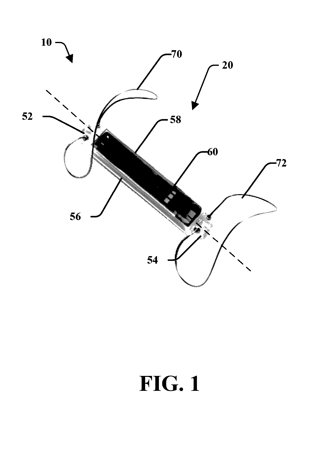 Pressure sensing implant