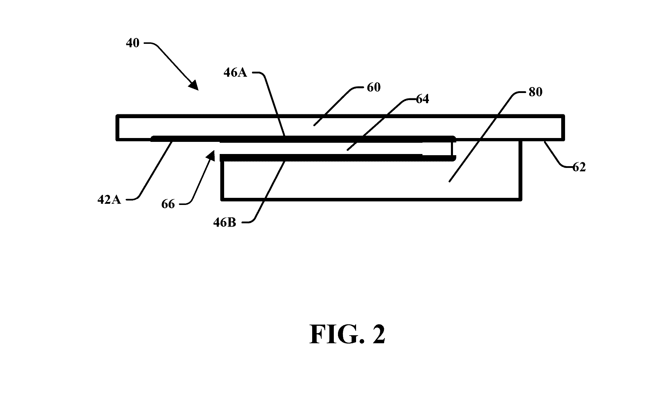 Pressure sensing implant