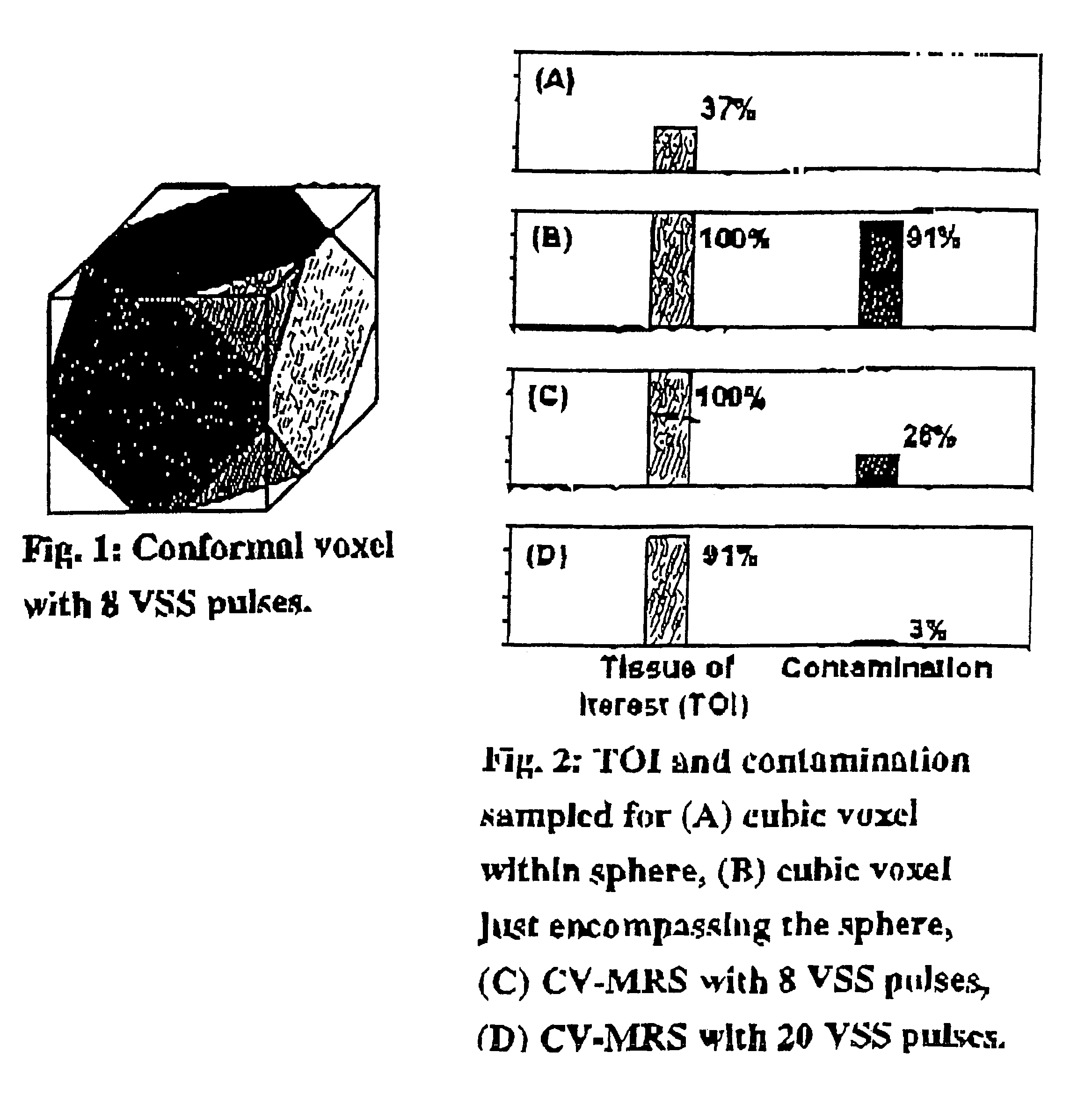 Magnetic resonance spectroscopy using a conformal voxel