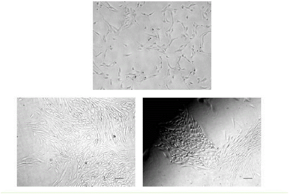 Isolated culture and differentiation method for testicular mesenchymal stem cells