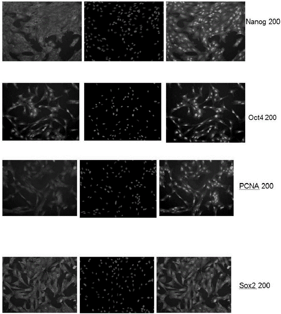 Isolated culture and differentiation method for testicular mesenchymal stem cells