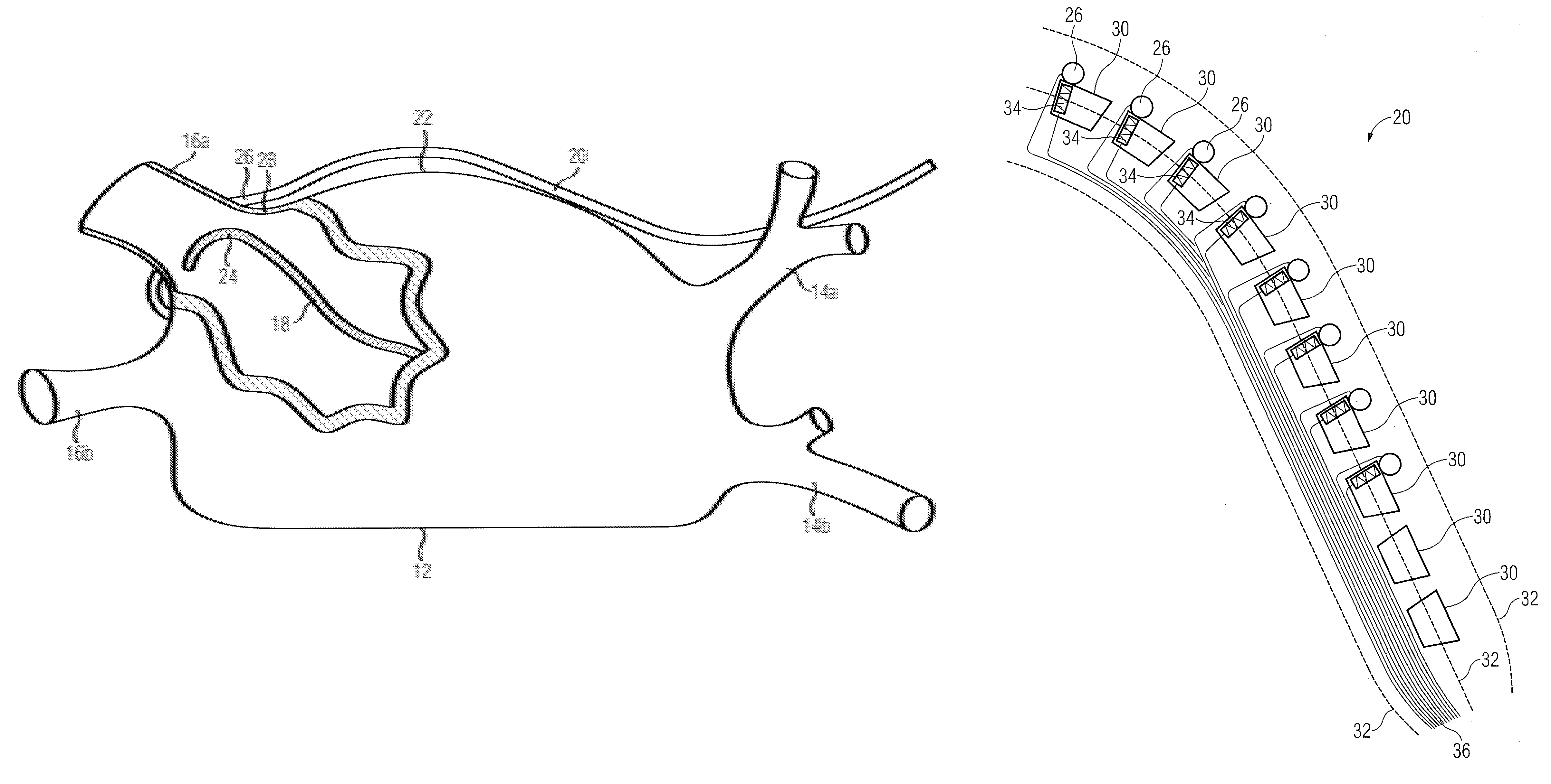 Pair of endocardial and epicardial catheters, catheter and method for positioning electrodes on a cardiac wall and method for the ablation of cardiac muscle tissue