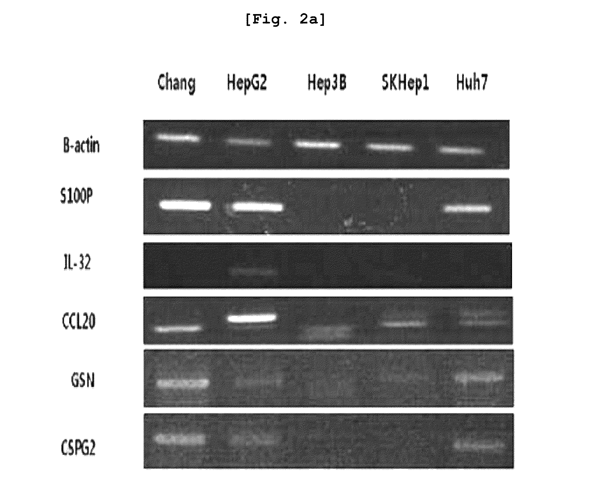 Novel biomarker for liver cancer and applications for same