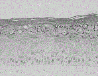 In-vitro skill model and keratinocyte cell long-acting culture solution