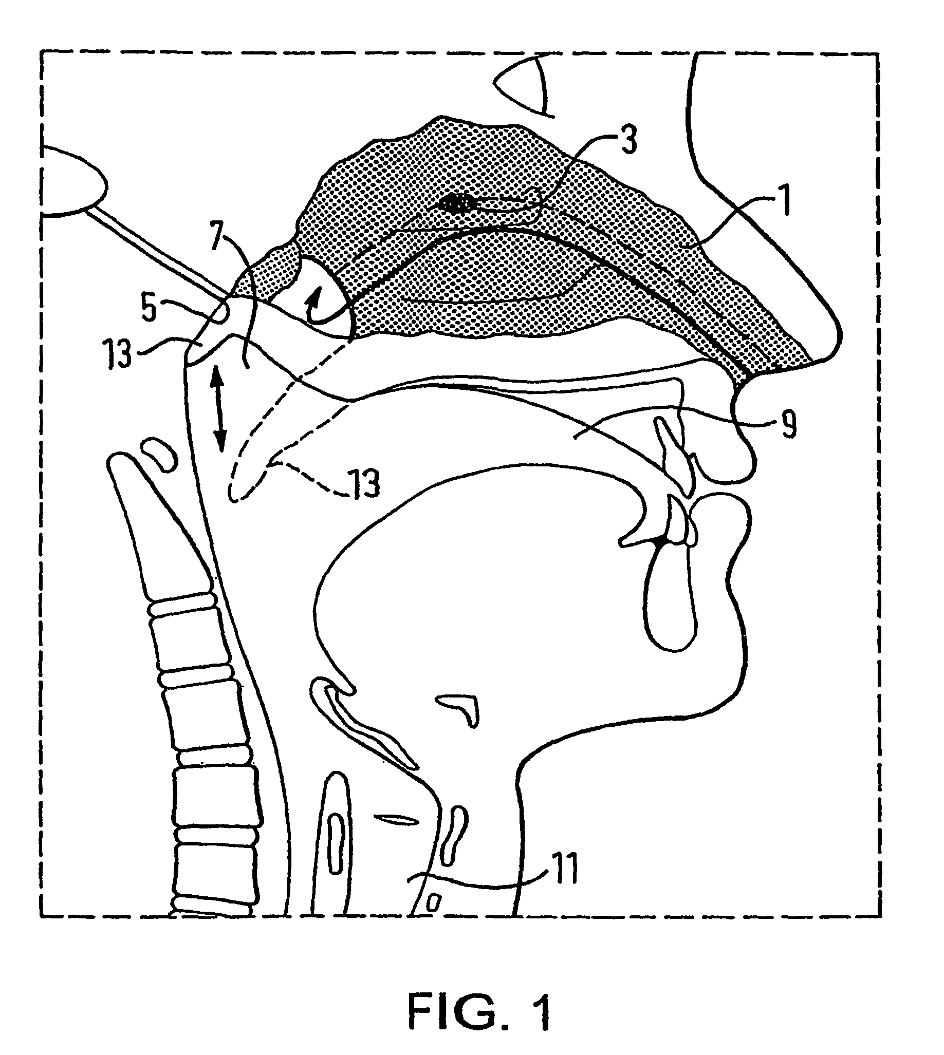 Nasal devices