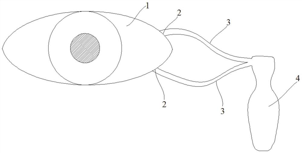 A kind of auxiliary device for diagnosis and treatment of lacrimal duct and its application