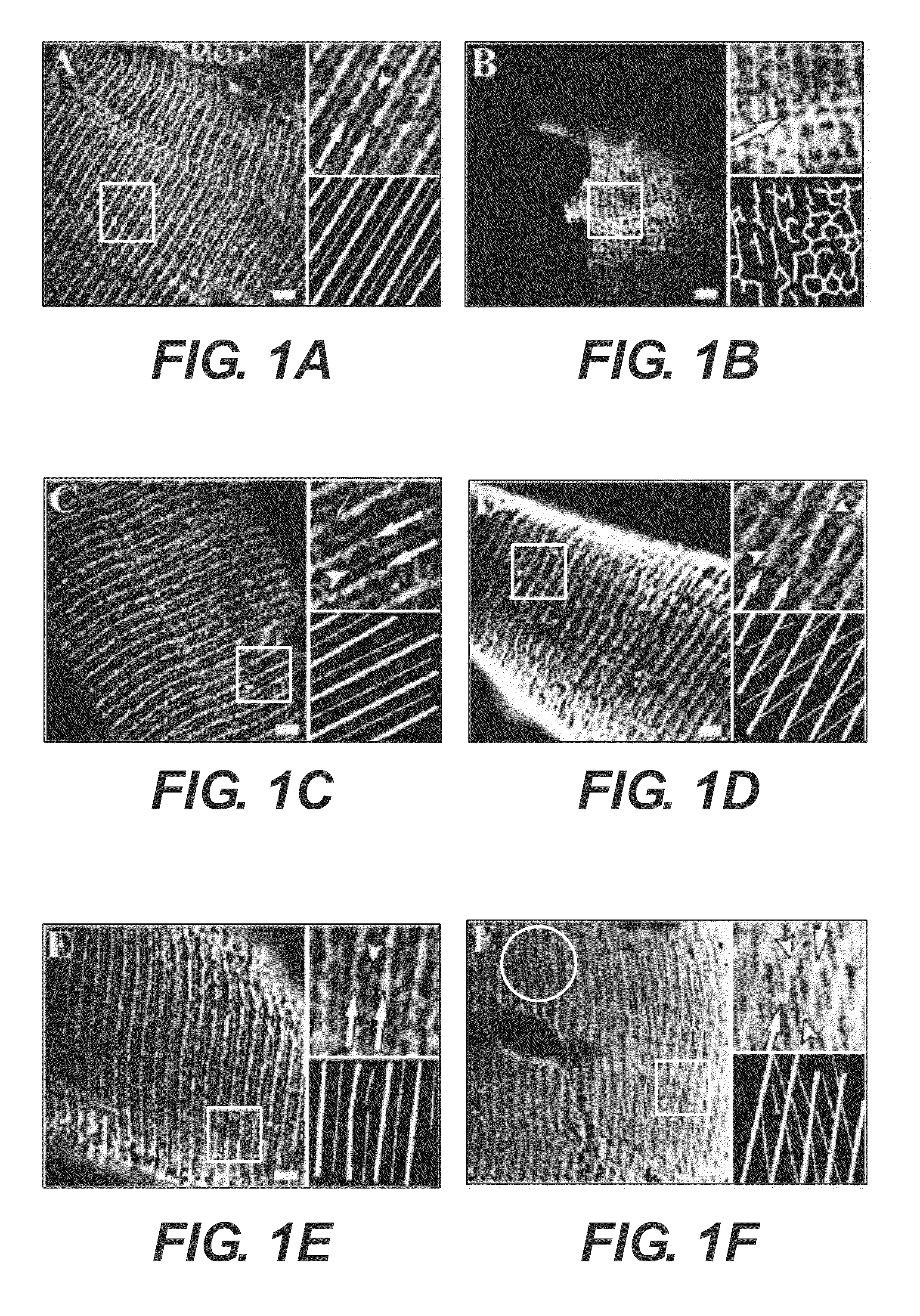 Methods of diagnosis and prognosis for a muscular dystrophy