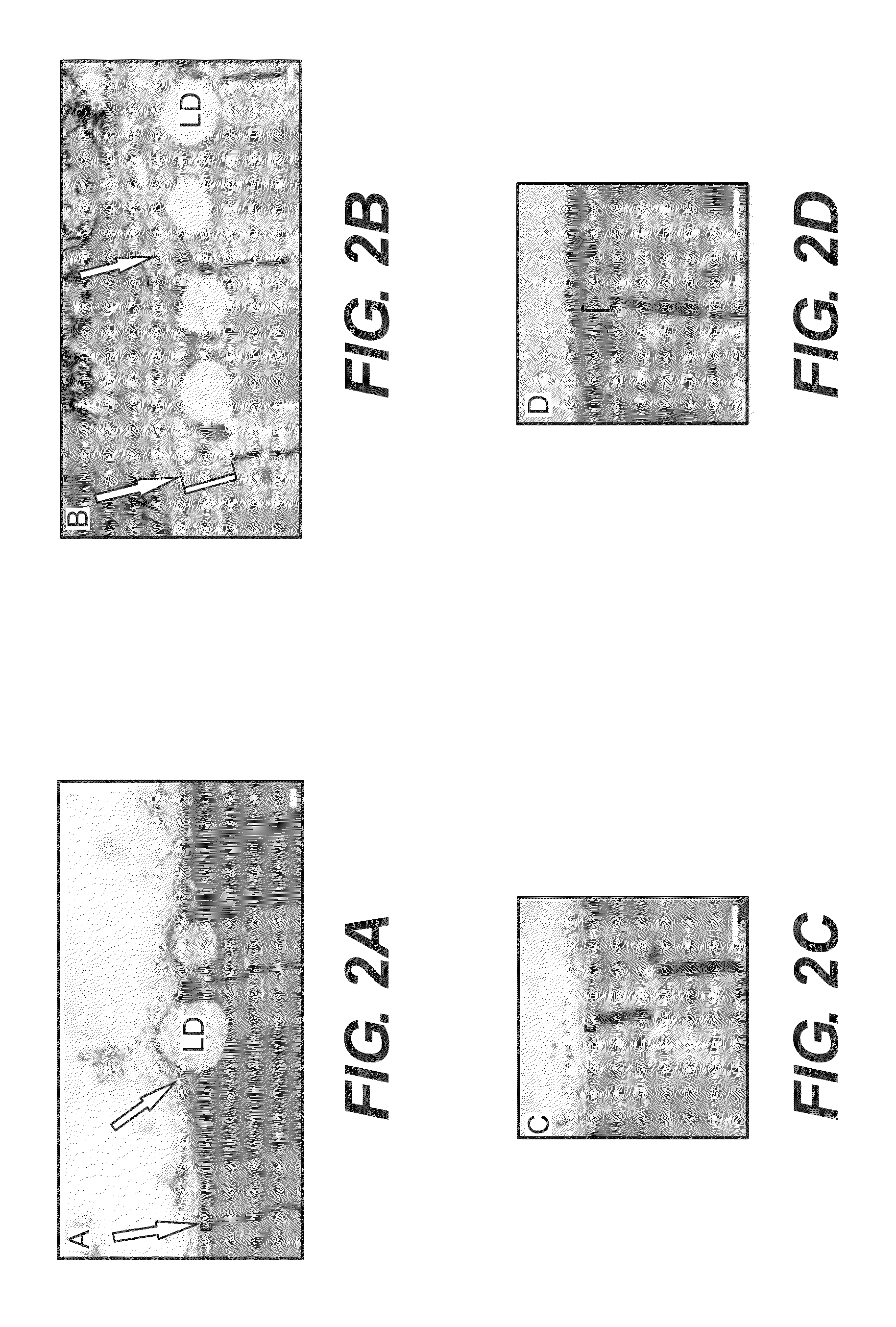 Methods of diagnosis and prognosis for a muscular dystrophy