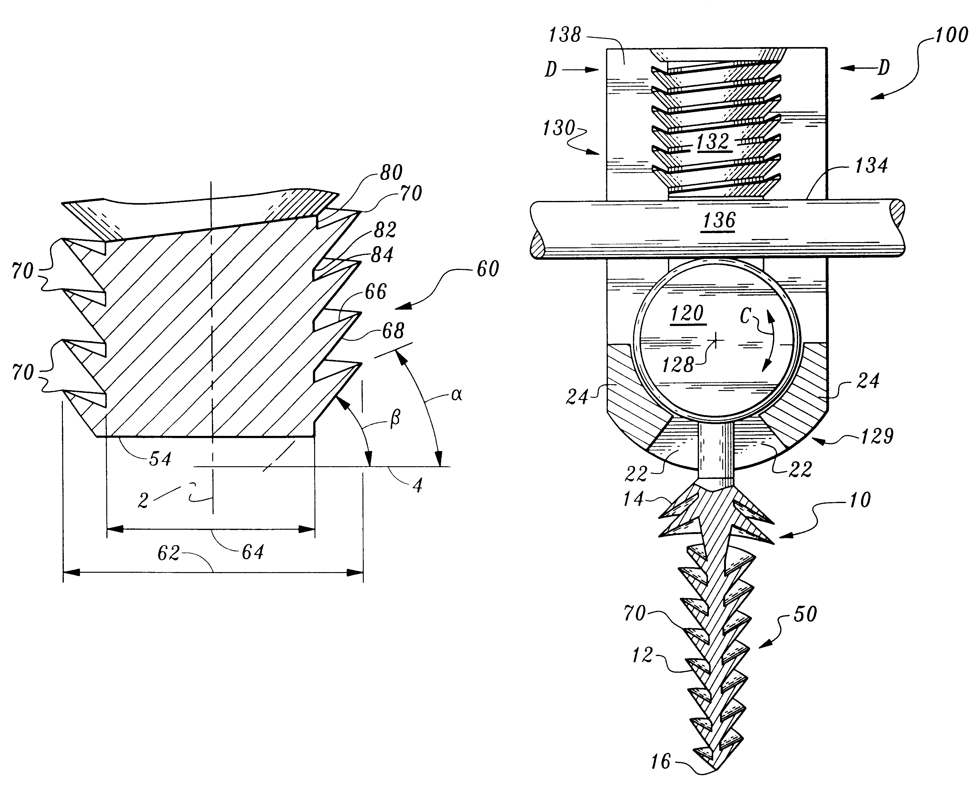 Orthopedic stabilization device and method