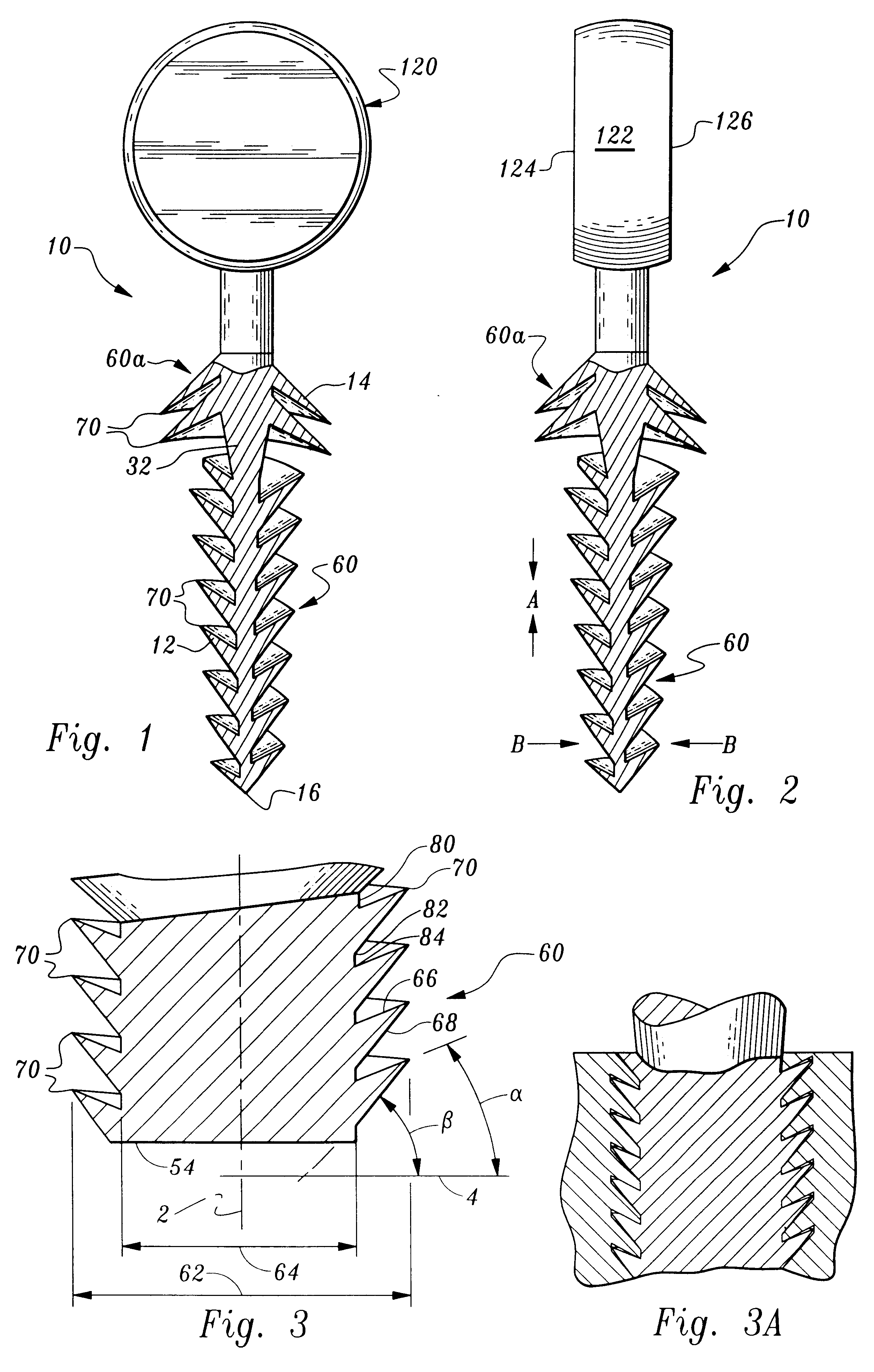 Orthopedic stabilization device and method