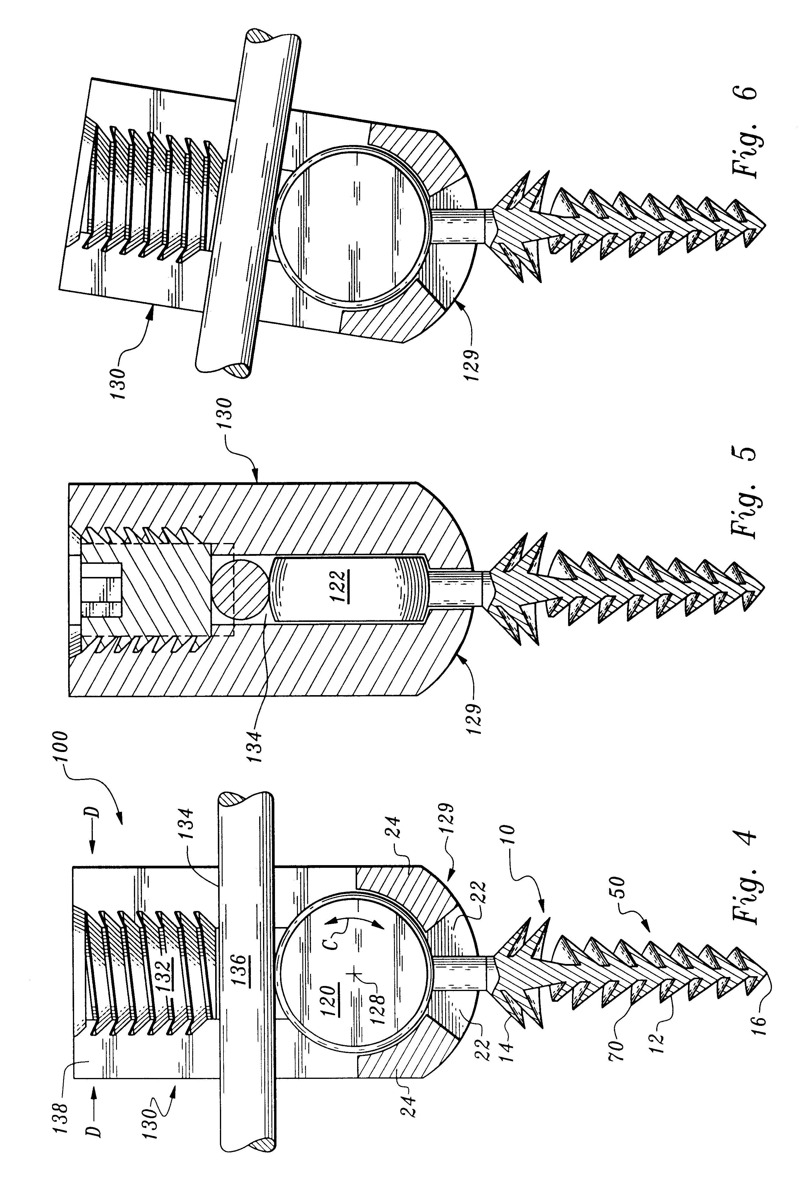 Orthopedic stabilization device and method