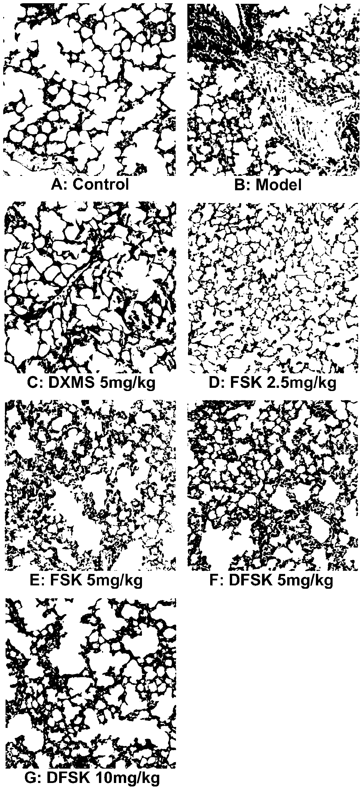 Application of forskolin and derivatives thereof in preparing anti-pulmonary fibrosis drug