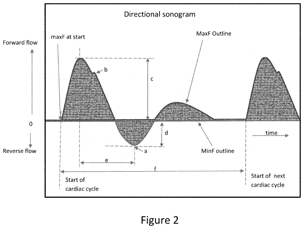 System For Determining Peripheral Artery Disease and Method of Use