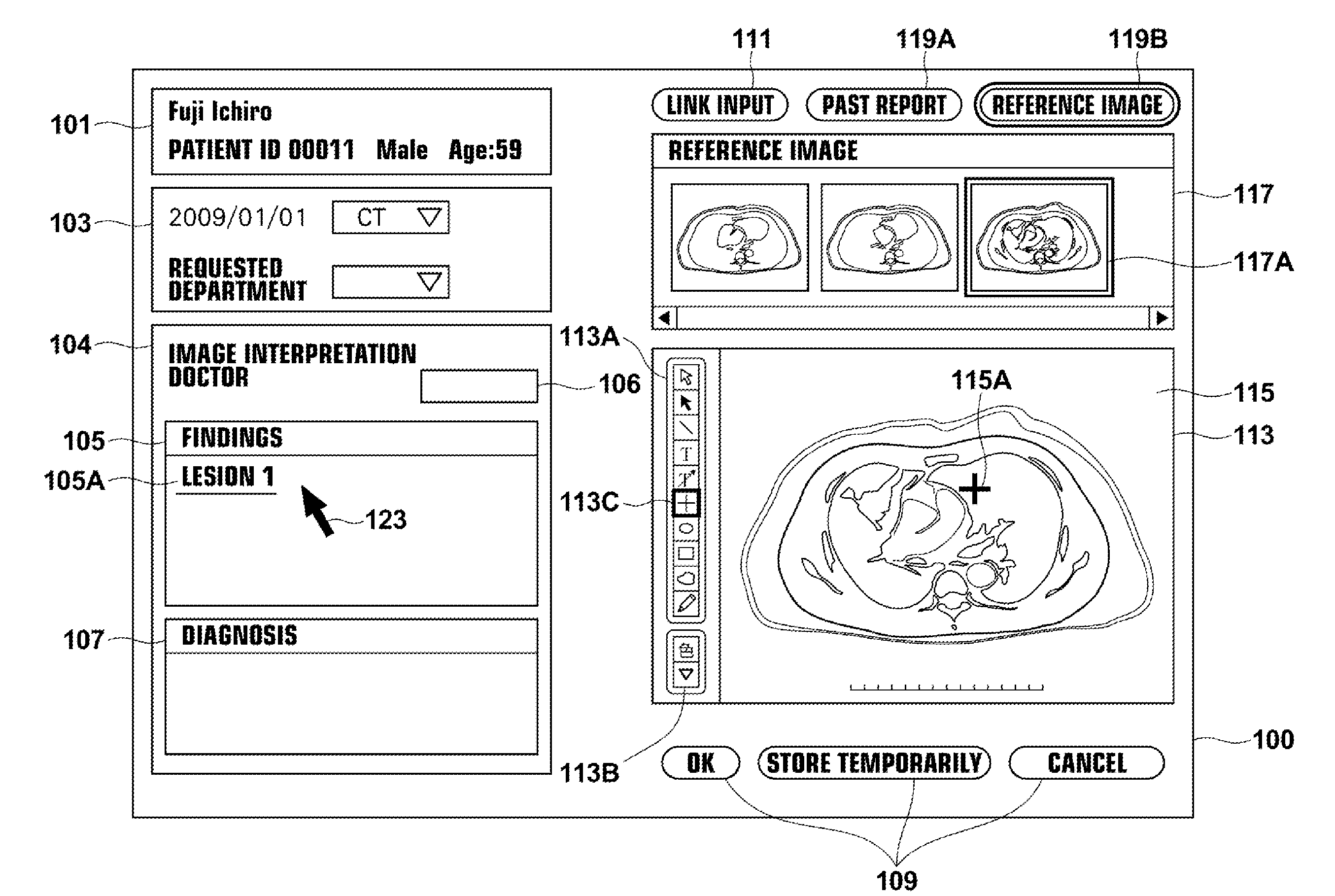 Image interpretation report generation apparatus, method and program