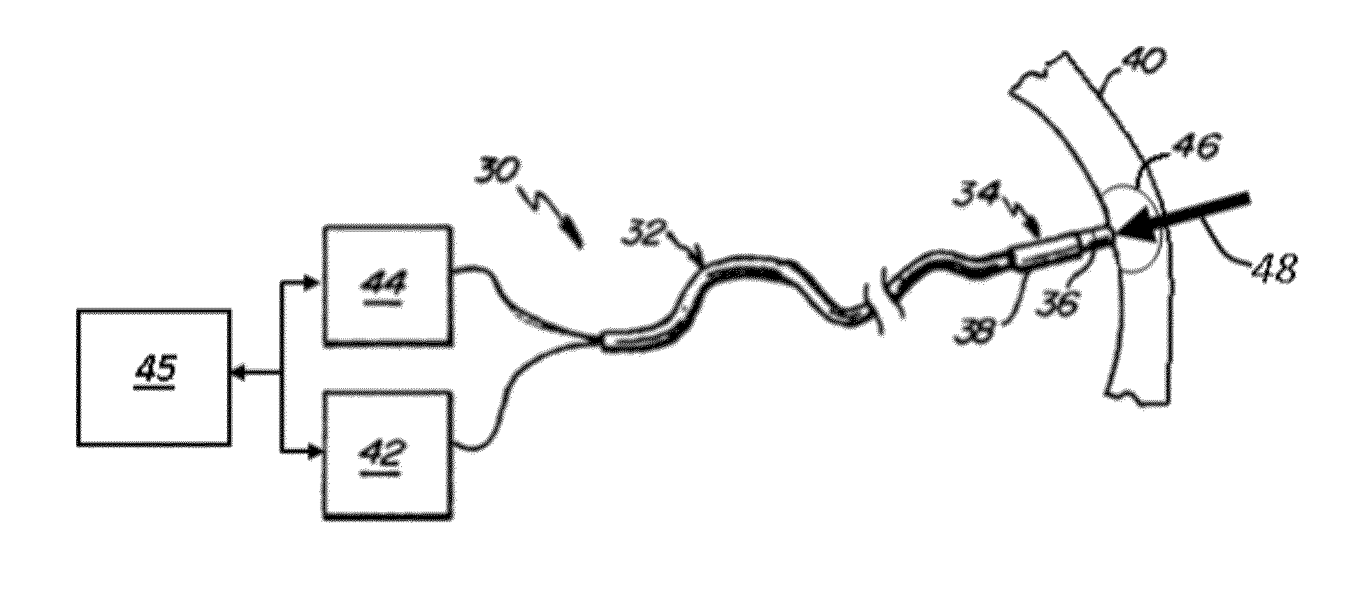 Prediction of atrial wall electrical reconnection based on contact force measured during RF ablation