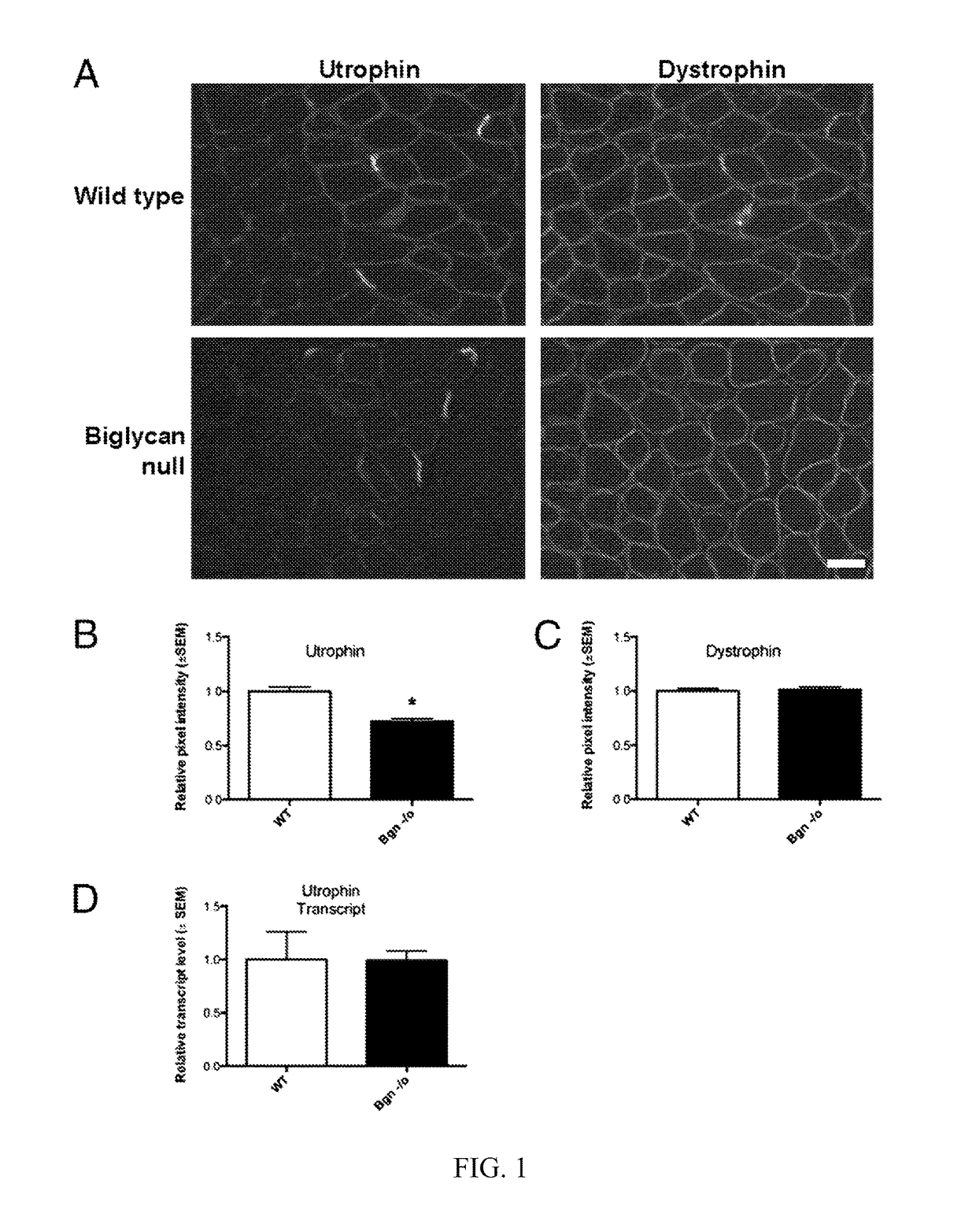 Therapeutic and diagnostic methods involving biglycan and utrophin