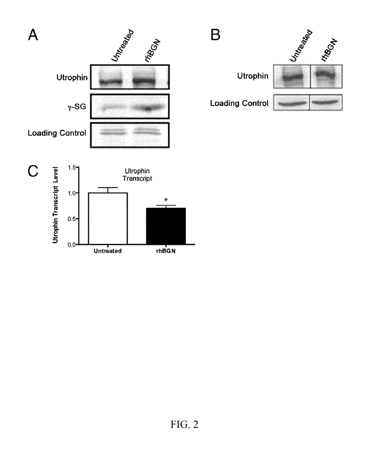 Therapeutic and diagnostic methods involving biglycan and utrophin