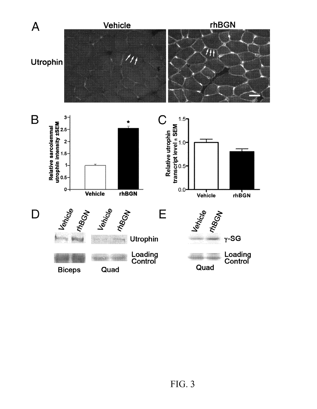 Therapeutic and diagnostic methods involving biglycan and utrophin