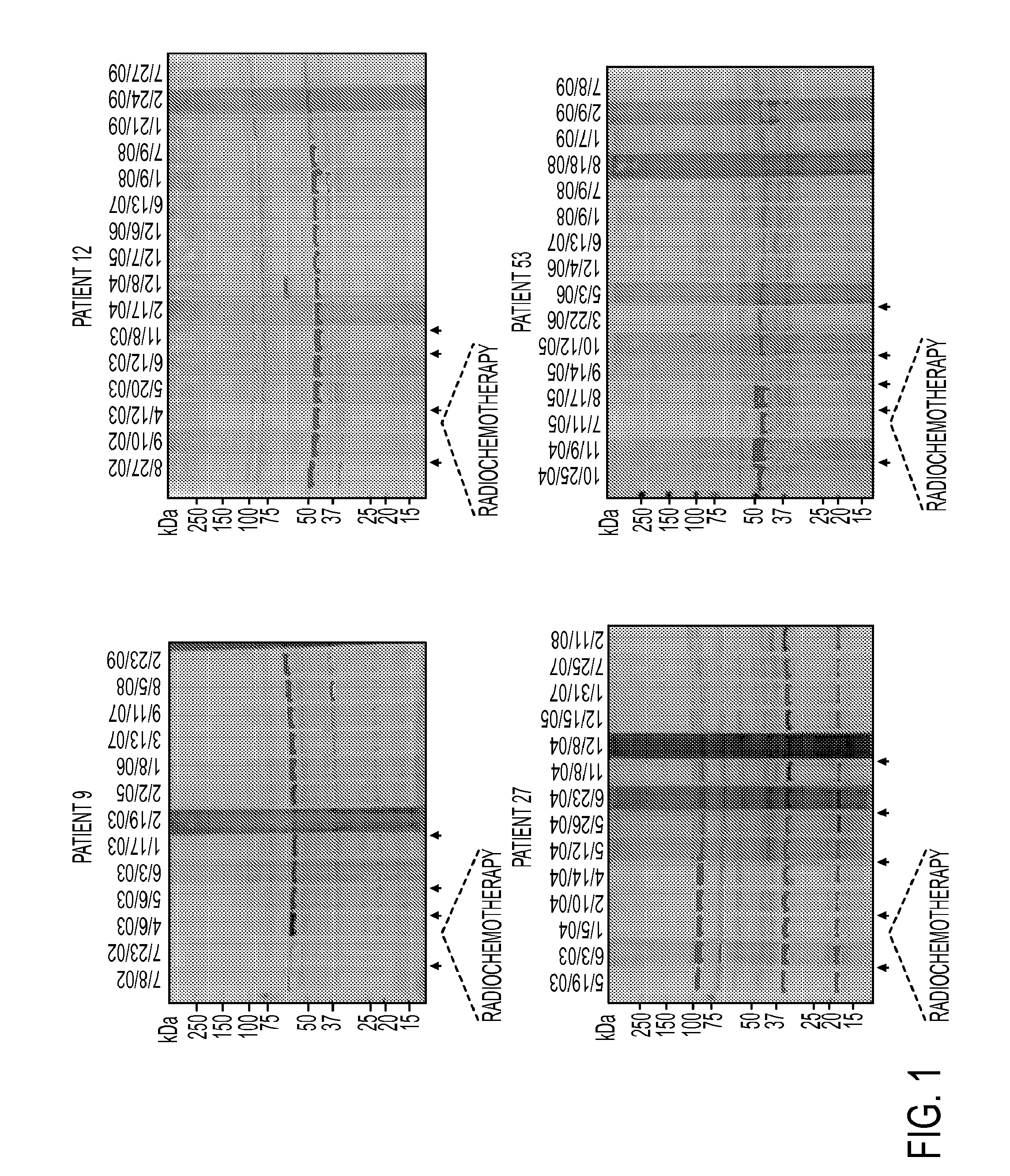 Annexin A2 as Immunological Target